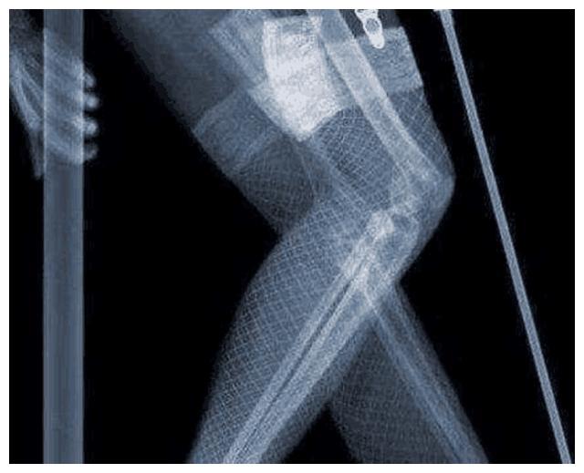 AG亚娱集团官方